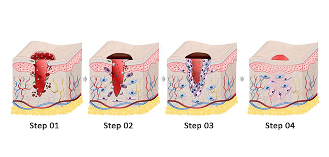 picture showing how infrared heating can help with the healing process in humans